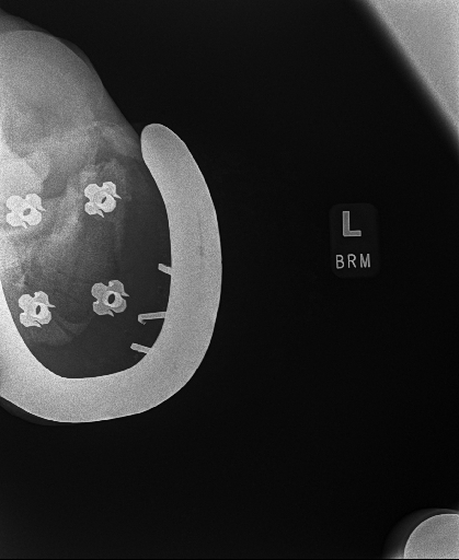 20240629radiograph_11