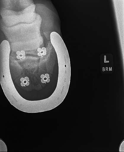 20240629radiograph_14