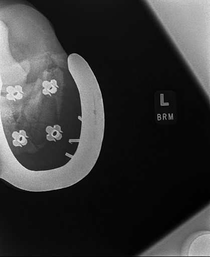 20240629radiograph_20