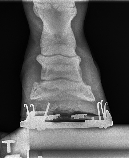 20240629radiograph_5