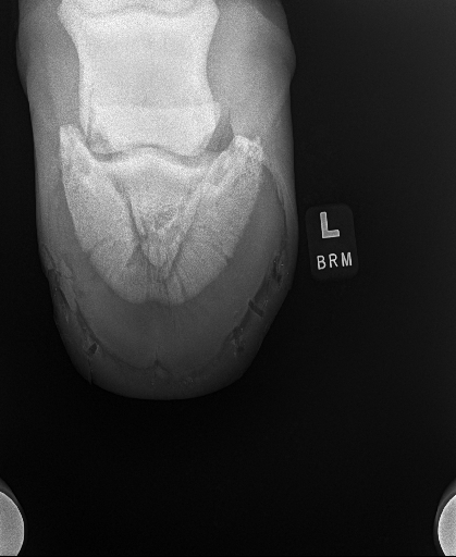 20240709radiograph_10