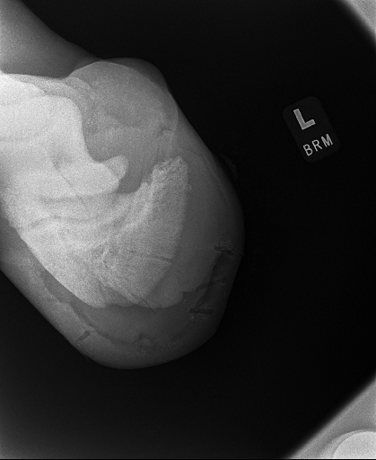 20240709radiograph_16