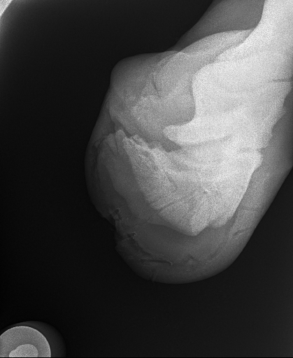 20240709radiograph_19