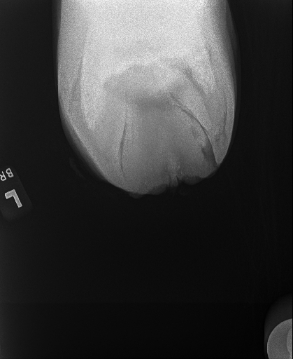 20240709radiograph_22