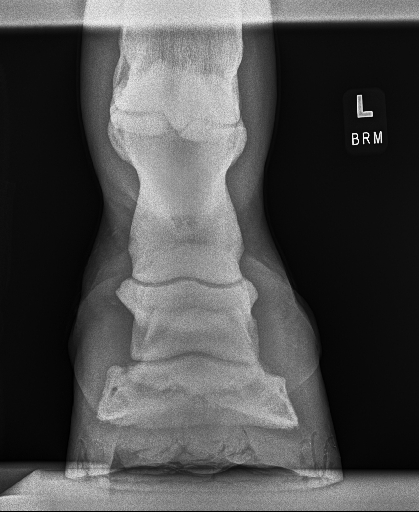 20240709radiograph_4