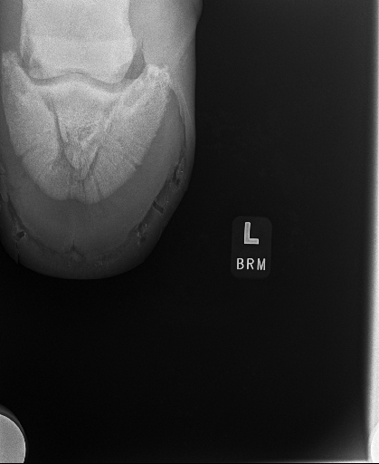 20240709radiograph_7